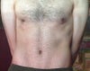 Left breast is "puffer" and left nipple is brighter and bigger.