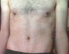 Left breast is "puffer" and left nipple is brighter and bigger.