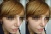 Left: Original photo / Right: Editet photo