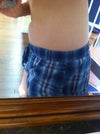 side view.  Will protrude more if I bend over more.  This is at it's best.