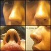 My nose from various views