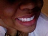 Took the piece off. See my tooth back there?