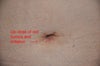 Up close view of my belly button.