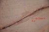 Up close of the mark around my scar.