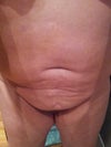 Front (waistband dent and strange belly button)
