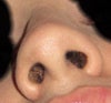 before under view, nostrils symetrical