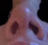 after under view, off to one side and different nostrils