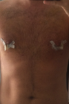 after (10 days)