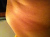 Stomach