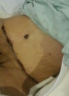 2 Days Post Op