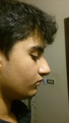 This is the damaged nose