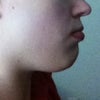 Forcing my lips closed from the side makes my chin look weird, as always
