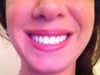 After, Smiling