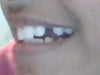 This is a bad pic but its the only one i could try to make, so ya. That is my gap.