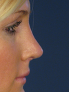 This is what I want my nose to look like.