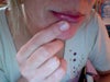 the bimp on my lip...