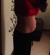 Right side view of abdomen