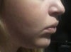 Current facial structure.