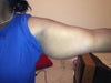 left upper arm