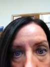 Help... What can I do to fix my under eye issues?