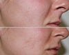 Evolence before & after photos