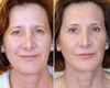Deep FX before & after photos