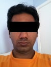 From front it is bloated
