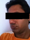 left side again