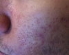Left side of face.