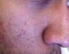 Right side of face.