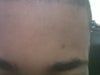 forehead