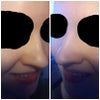Both sides compared
