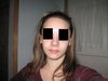 PRE op. Sorry, dont have photos of a base view pre op, this is the best I could do.