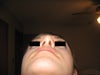 POST op, Base view.
