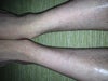 Hopefully the photo is clear, but they are oval shaped bald patches that are completely smooth.