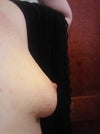 Side View of Left Breast
