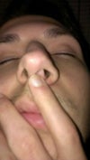 when moving my nostril to the right it exposes the septum pushing outwards