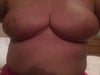 5 weeks post op - do these look like normal breasts?