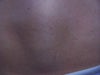 tummy 3