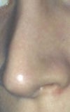 hard uneven lump down centre, raised bump to the surface