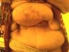 This is what my stomach is like. I look and feel like a freak. It's huge from new hernia. In a lot of pain and suffering. I have paper thin skin wall and no stomach muscle they say. They did a skin graph last time on me from my legs. Please help me...