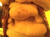 This is what my stomach is like. I look and feel like a freak. It's huge from new hernia. In a lot of pain and suffering.