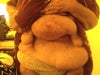 This is what my stomach is like. I look and feel like a freak. It's huge from new hernia. In a lot of pain and suffering.