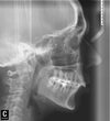I just got soft copies of my x-rays :)