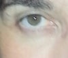 first treatment results