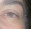 Now....under right eye