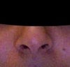 before op, dont think i had uneven nostrils to begin with