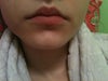 Natural lips again
