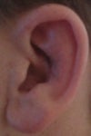 left ear