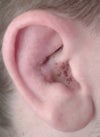 right ear